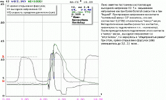 Oxygen Sensor a 4A-FE Engine (Avensis)